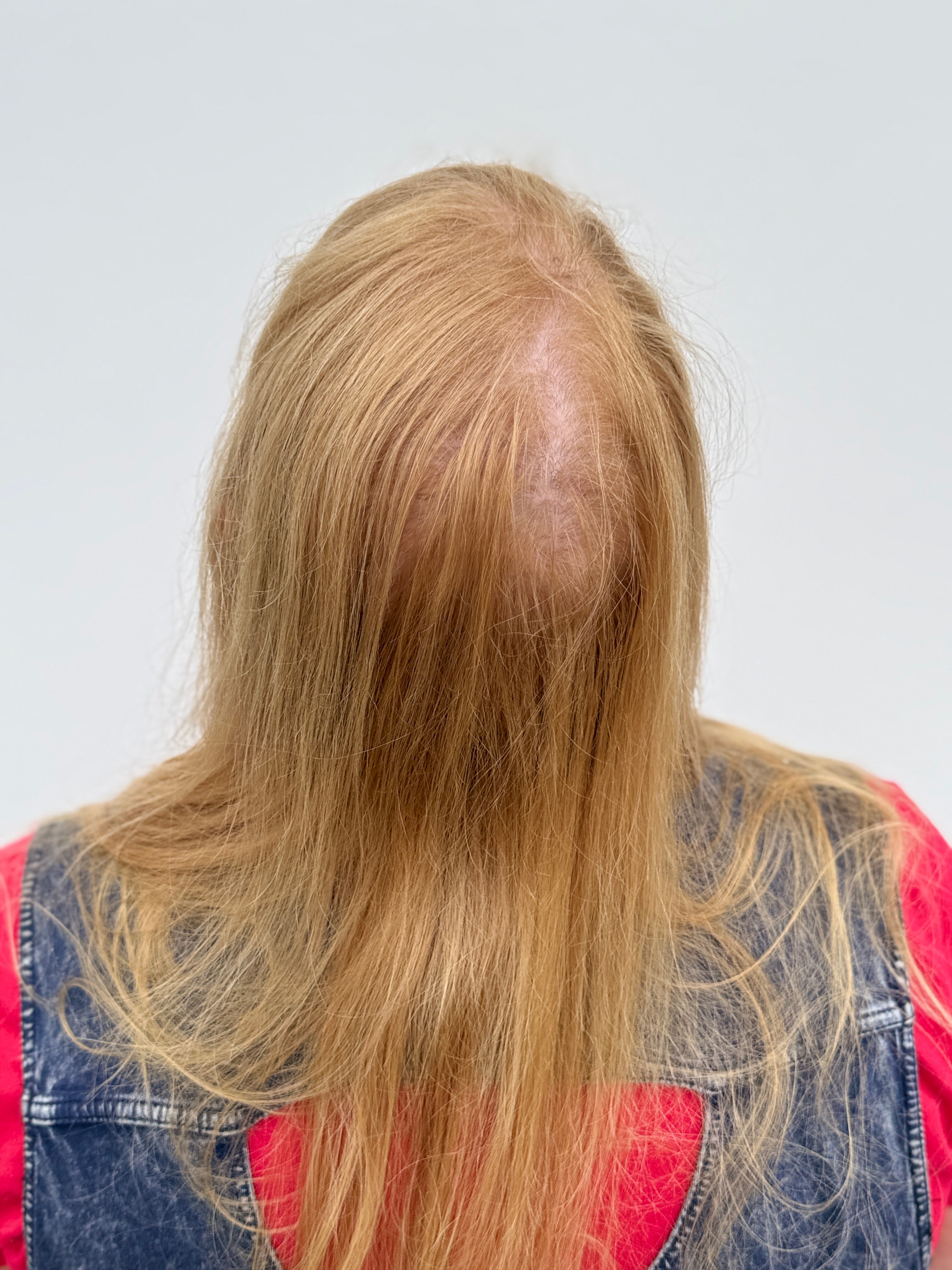 Studio Élan Hair Topper Before Photo